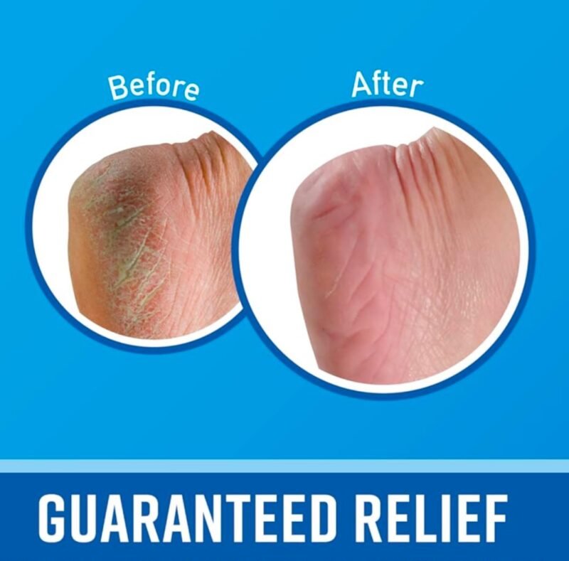 O'Keeffe's for Healthy Feet Foot Cream