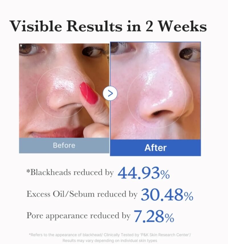 Medicube Zero Pore Pad 2.0