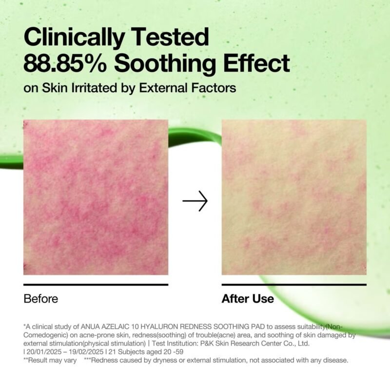 Anua Azelaic 10 Hyaluron Redness Soothing Pad 230ml