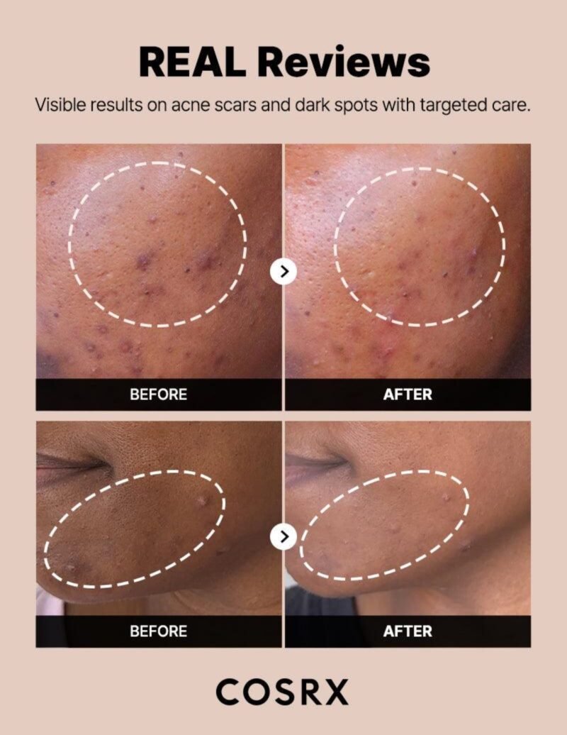 Cosrx The Alpha - Arbutin 2 Discoloration Care Serum - 50ml