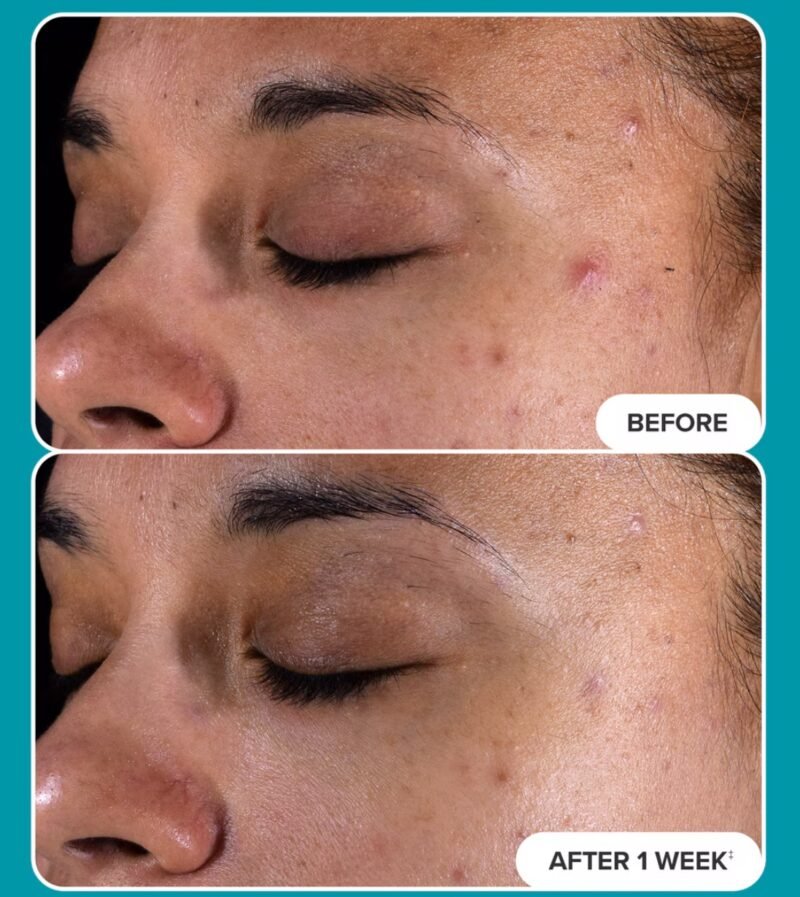 Paula’s Choice 2% BHA Liquid Exfoliant - 30ml