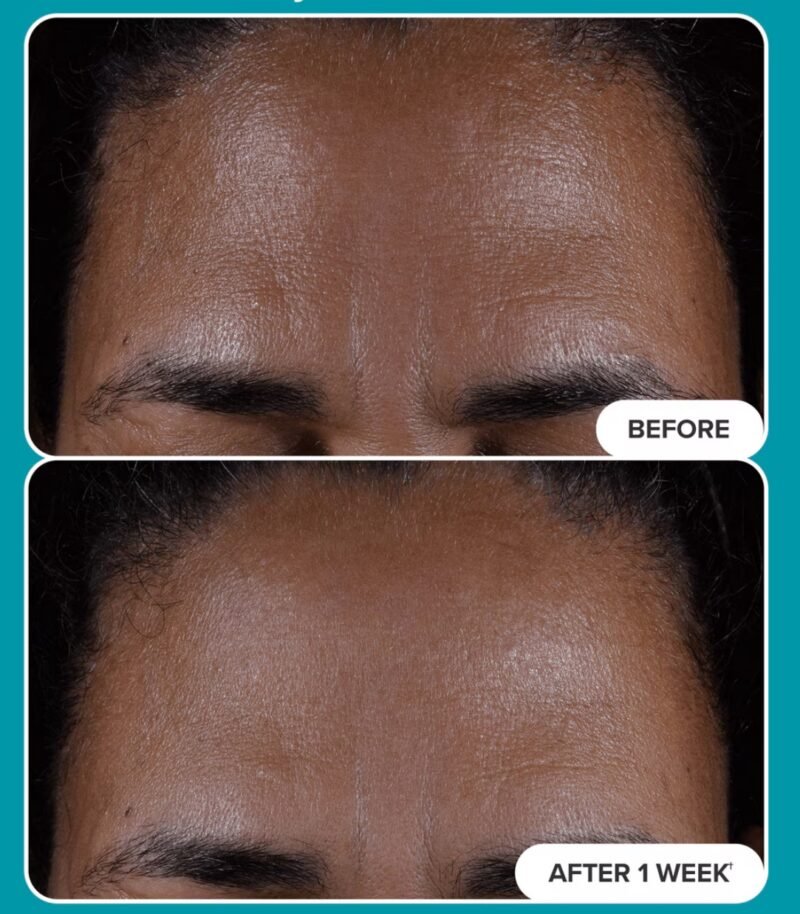 Paula’s Choice %2 BHA Liquid Exfoliant - 118ml