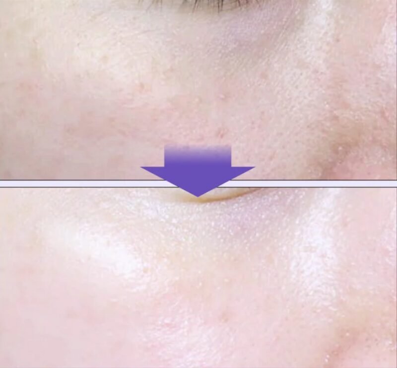 Dermafirm Soothing Repair Toning Cream R4 - 50ml