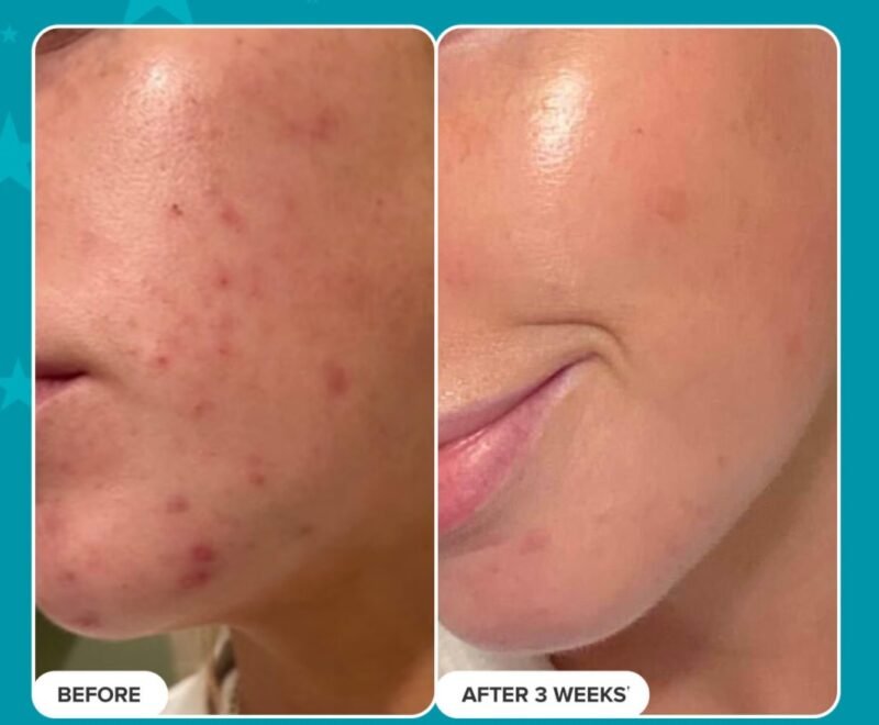 Paula’s Choice Greatest Hits Collection Set