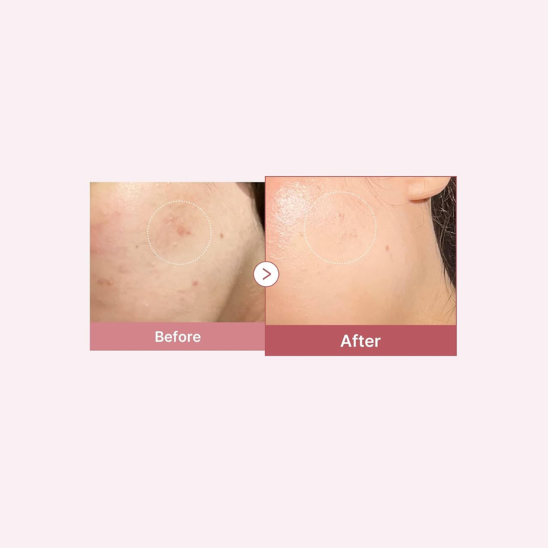 Medicube PDRN Pink Hyaluronic Moisturizing Cream - 50ml