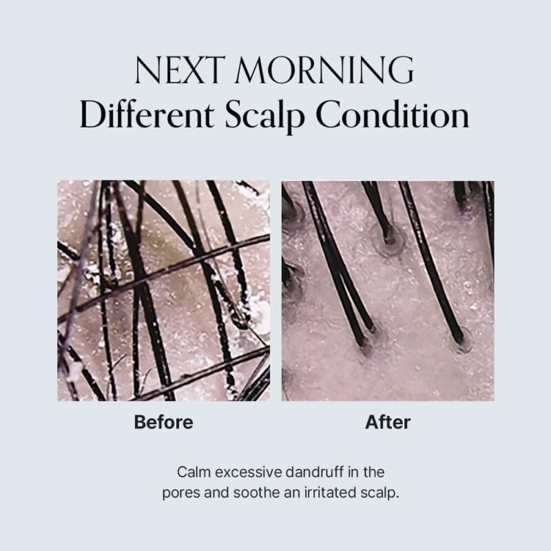 img_4346-3 Growus Damage Therapy Scalp Scaling Ampoule 50g