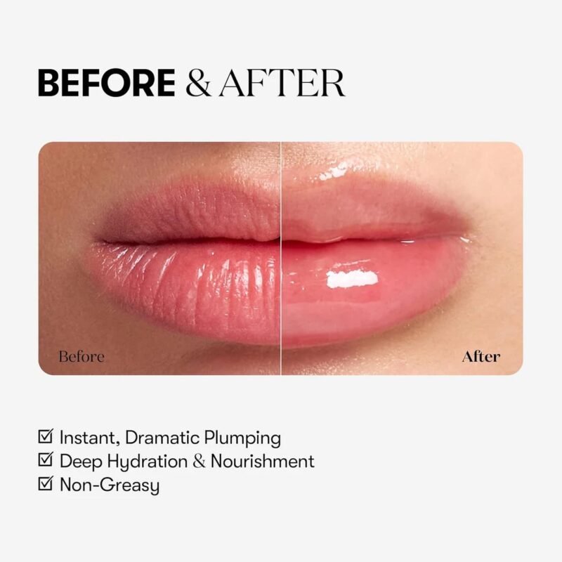 Reedle Shot Lip Plumper (EXPERT)