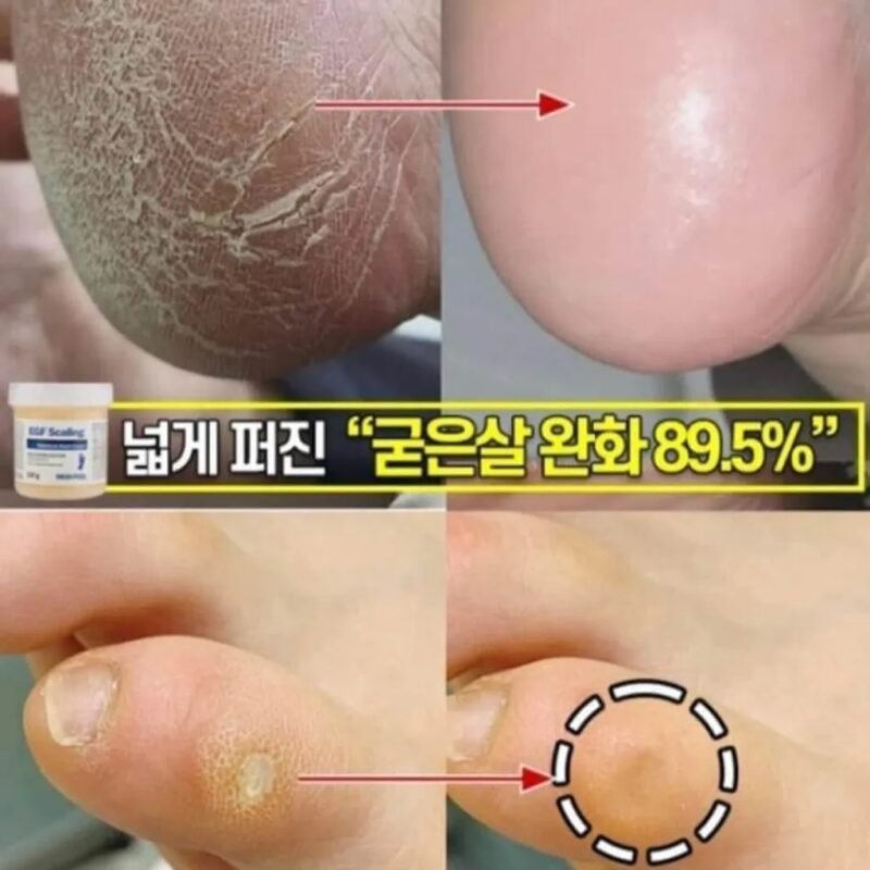 ‏MediPeel EGF Scaling Moisture Foot Cream 130