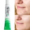 Dong-A Pharmaceutical Aclean Gel a treatment for acne 20g