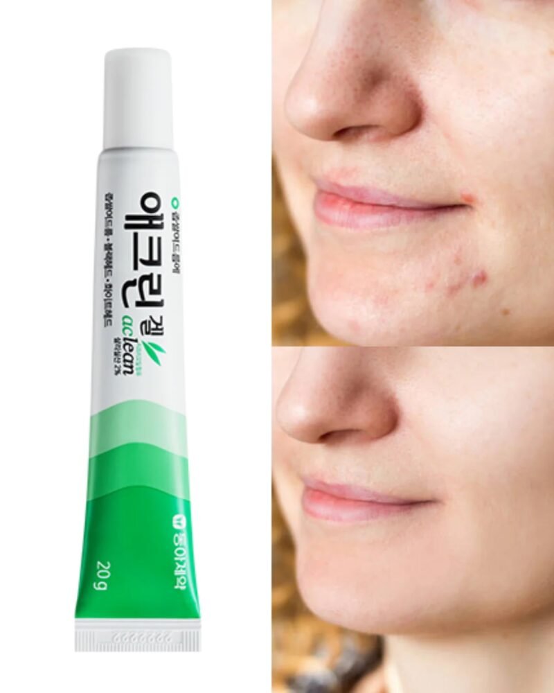 Dong-A Pharmaceutical Aclean Gel a treatment for acne 20g