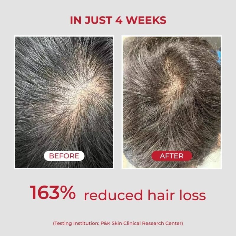 MOEV ANNURCATIN Shampoo 525ml