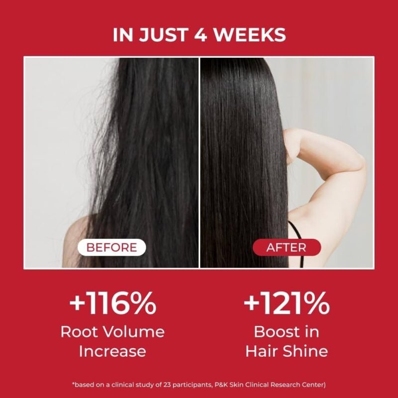 MOEV ANNURCATIN Shampoo 525ml