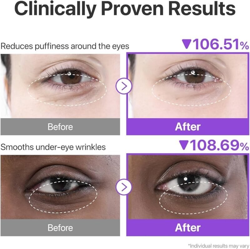 Numbuzin No.9 NAD+ Collagen under Eye Patches 8g