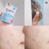 Care plus Scar Cover Spot Patch 102 piece