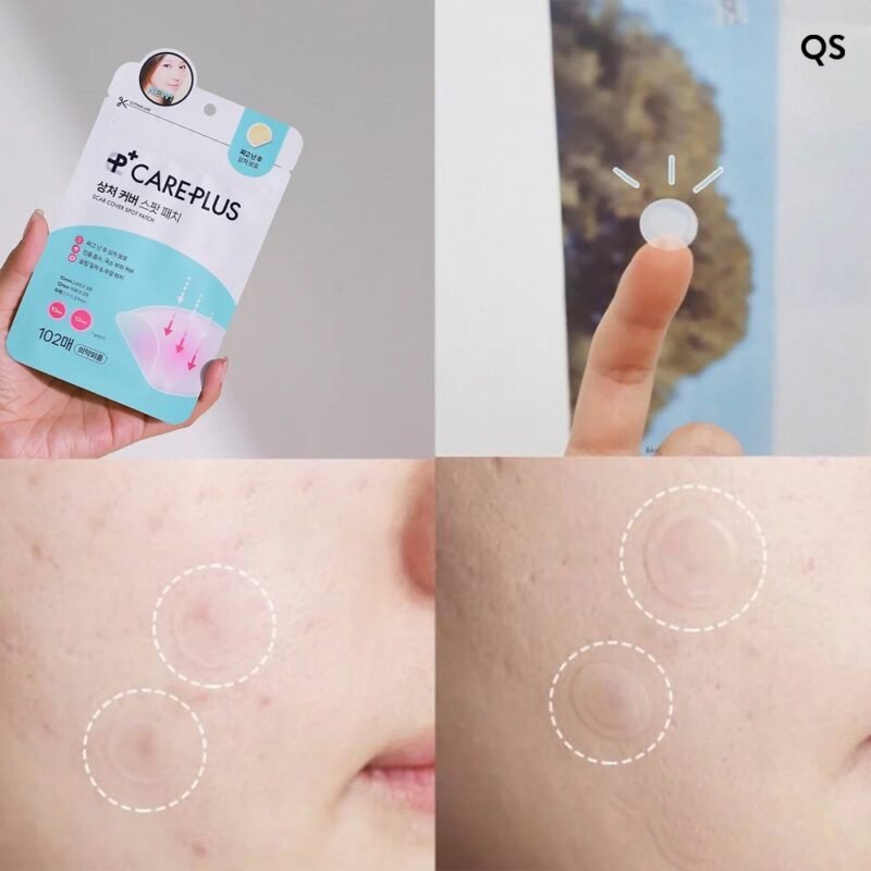 Care plus Scar Cover Spot Patch 102 piece