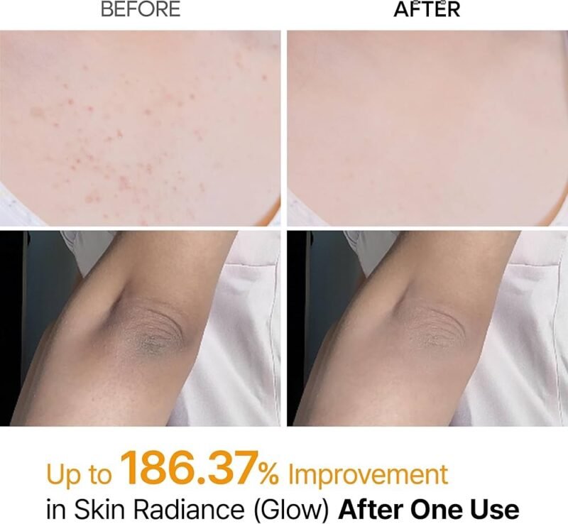 img_5469 Dr.Melaxin Peel Shot Body Exfoliator Spray 200ml