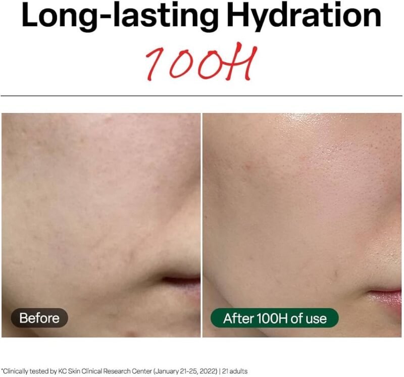 img_6219-2 Dr.G Red Blemish Clear Soothing Cream 70 ml