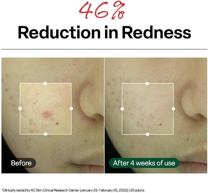 img_6220-2 Dr.G Red Blemish Clear Soothing Cream 70 ml
