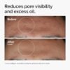 img_0210-2 THE ORDINARY Niacinamide 10% + Zinc 1% 30 ml