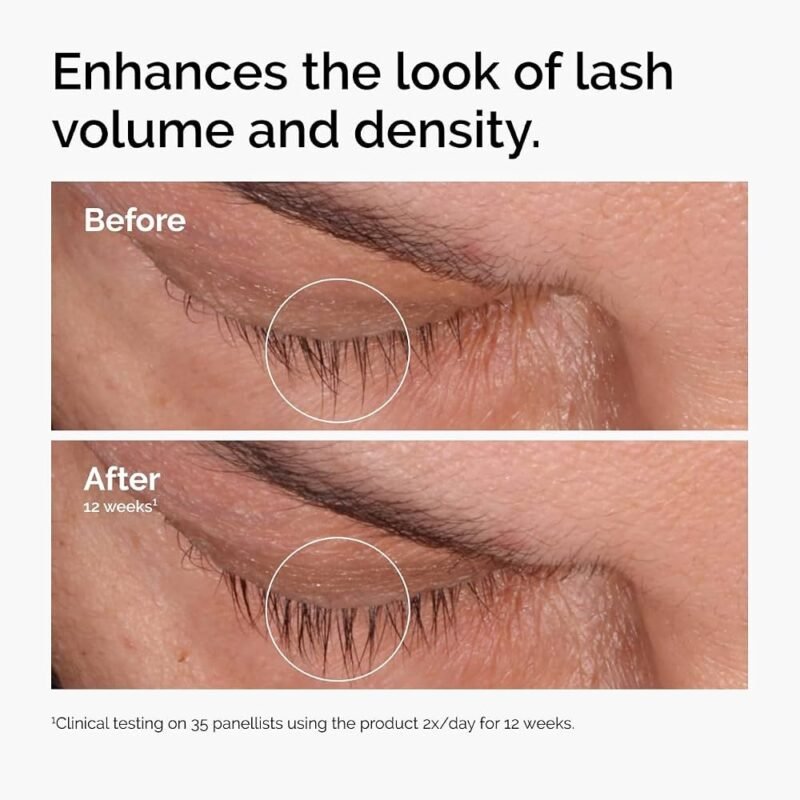 img_0219-4 The Ordinary Multi-Peptide Lash and Brow Serum 5ml