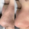 img_9763 Dr. Althea 2% Salicylic Acid Clear Pad 65pads