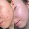 img_9764-3 Dr. Althea 2% Salicylic Acid Clear Pad 65pads