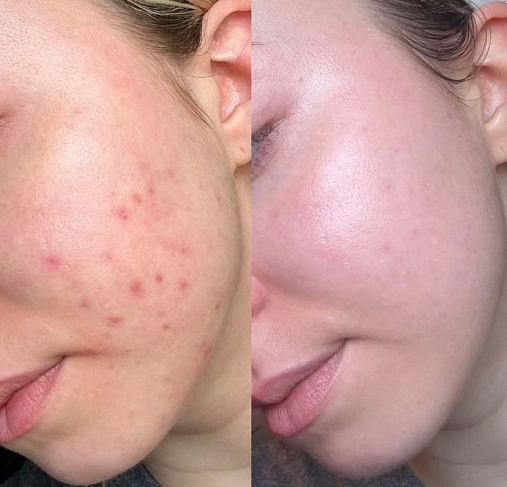 img_9764-3 Dr. Althea 2% Salicylic Acid Clear Pad 65pads