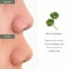 img_9767-2 Dr. Althea 2% Salicylic Acid Clear Pad 65pads
