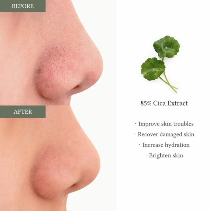 img_9767-2 Dr. Althea 2% Salicylic Acid Clear Pad 65pads