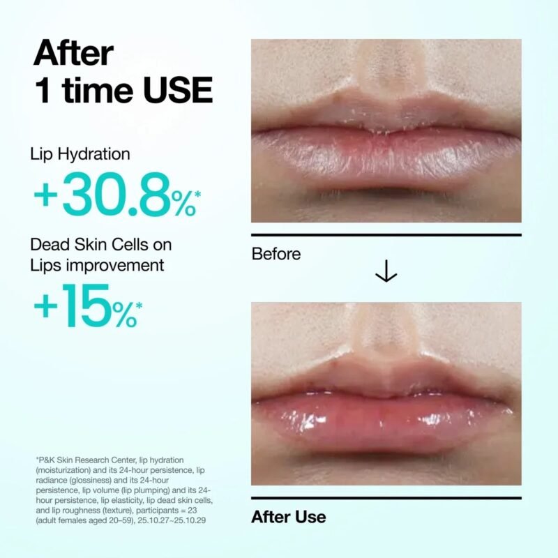 img_3195-3 Anua pdrn hyalu lip serum 10 ml